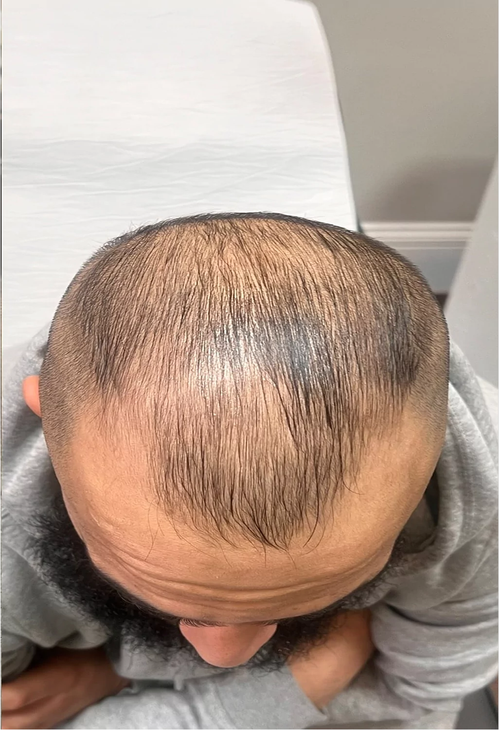 Before