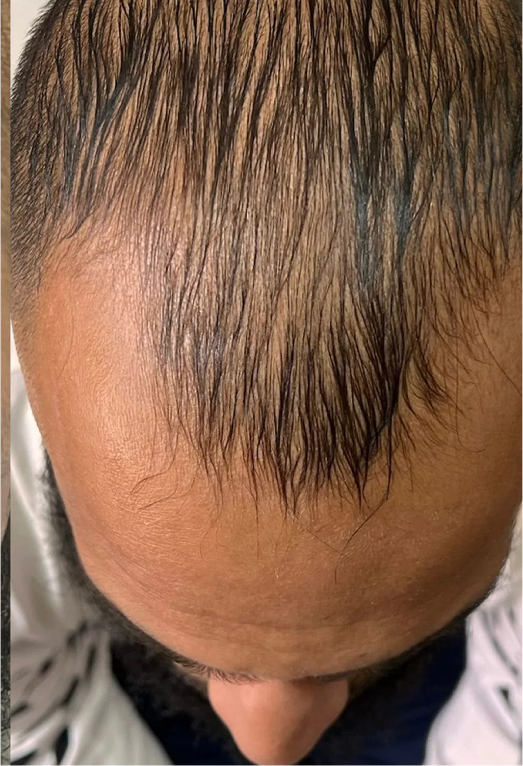 Before