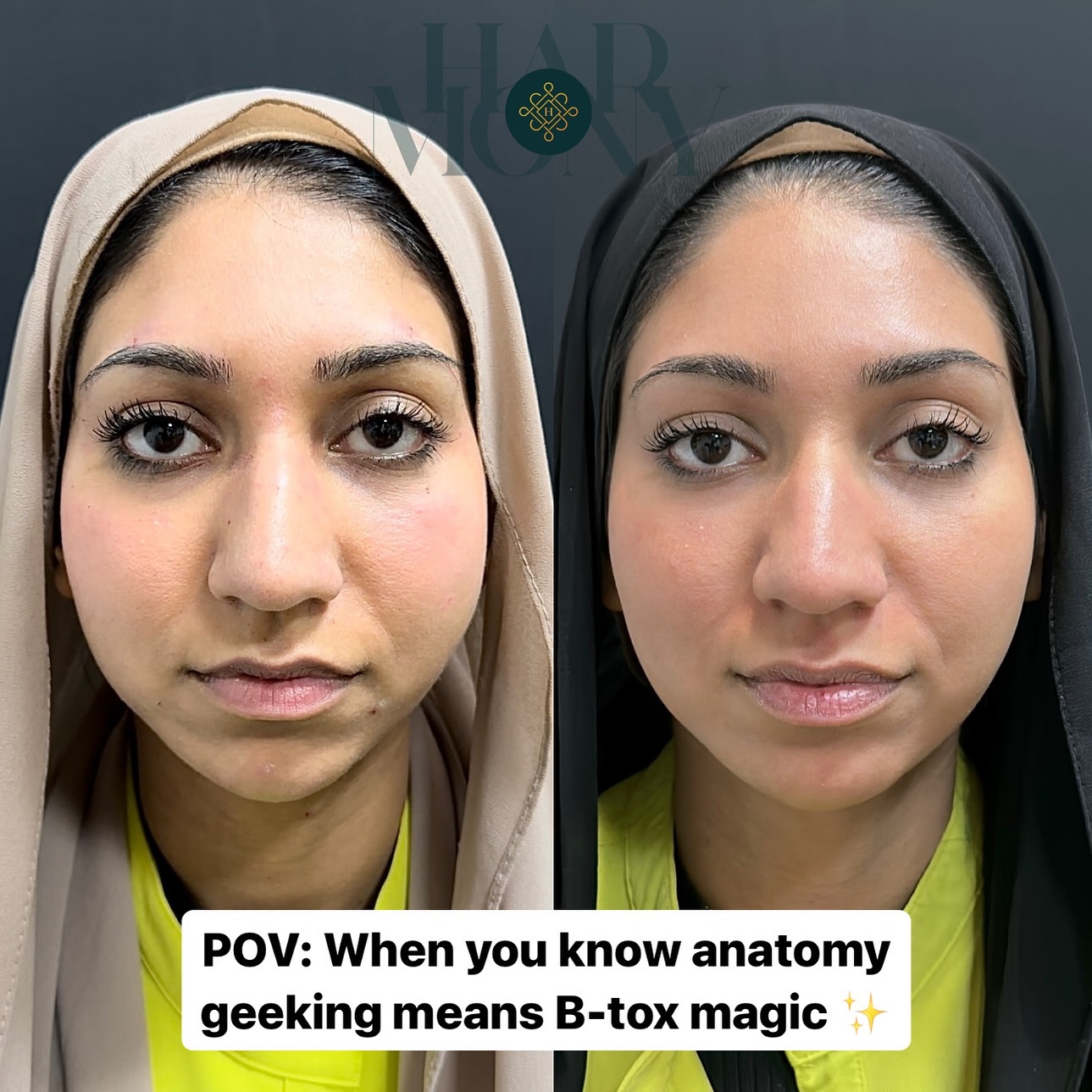 Photo by Harmony Medical Aesthetics in Harmony Medical by Dr Ayah with @dr.ayah.s.