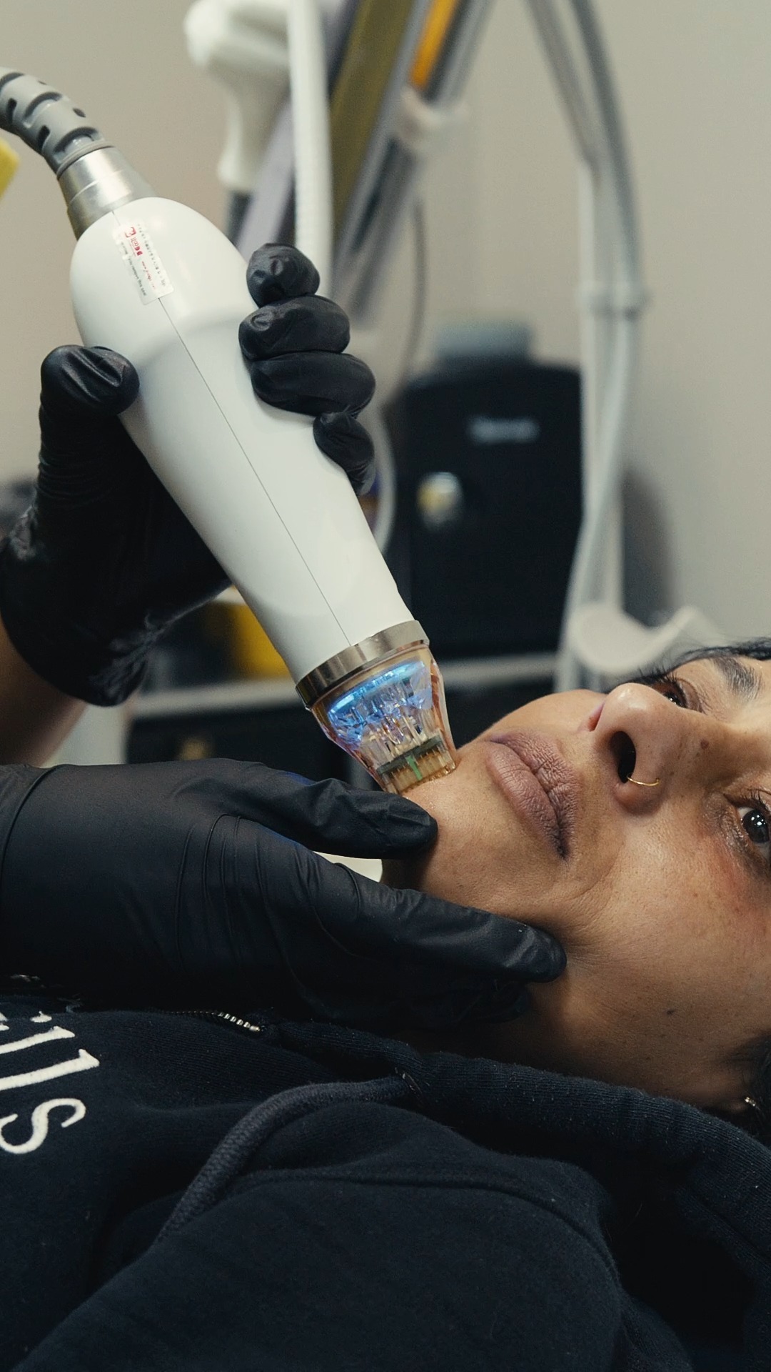 Hey guys! Have you ever wondered what it's like to visit us in clinic? This is a sneak peek into what you can expect when you visit us in our Halifax Clinic! Did you know... - We have a full tester bar with ALL our products, including an amazing Korean Range! - You can purchase skincare, directly in clinic! (the team are on hand for recommendations too!) - We have two treatment rooms, ready to go! - We have AMAZING devices, including Pico Laser, Co2, Radiofrequency and so much more! - Coffee on tap, for when you need it 🤫 We've got another wonderful clinic in London too, also kitted out with amazing devices!! We're so excited to see you in clinic. You can book in using the links in our profile, or just send me a DM / call on 07355045597 and I'd be happy to help! Amina - Team Harmony ❤️