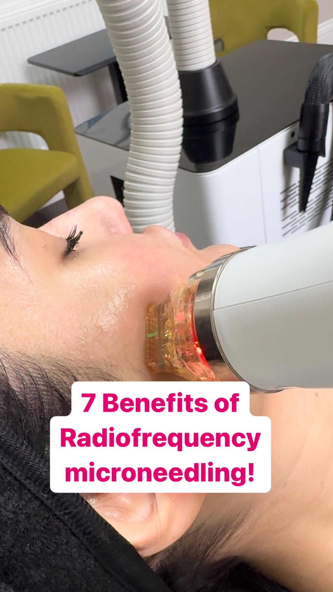 Are you suitable for this fabulous treatment? Find out by contacting us! WhatsApp: 07355 045597 Email: info@harmonymedical.uk Or simply DM us to book in!