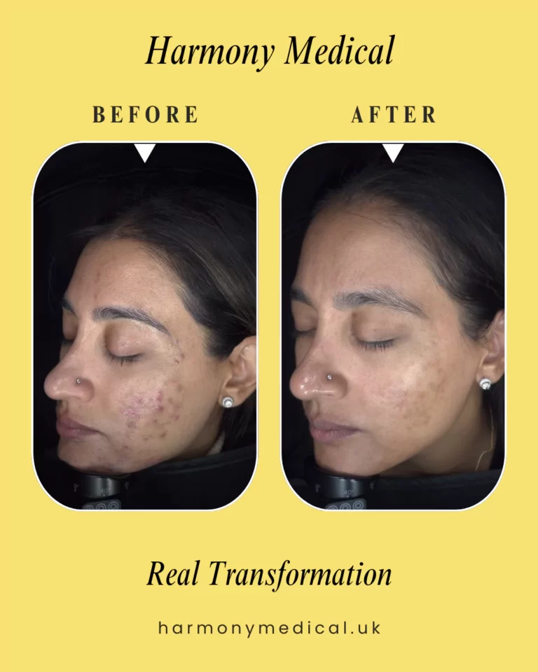 harmony-medical-before-after-img-019