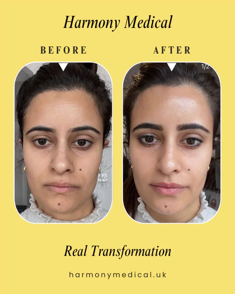 harmony-medical-before-after-img-020