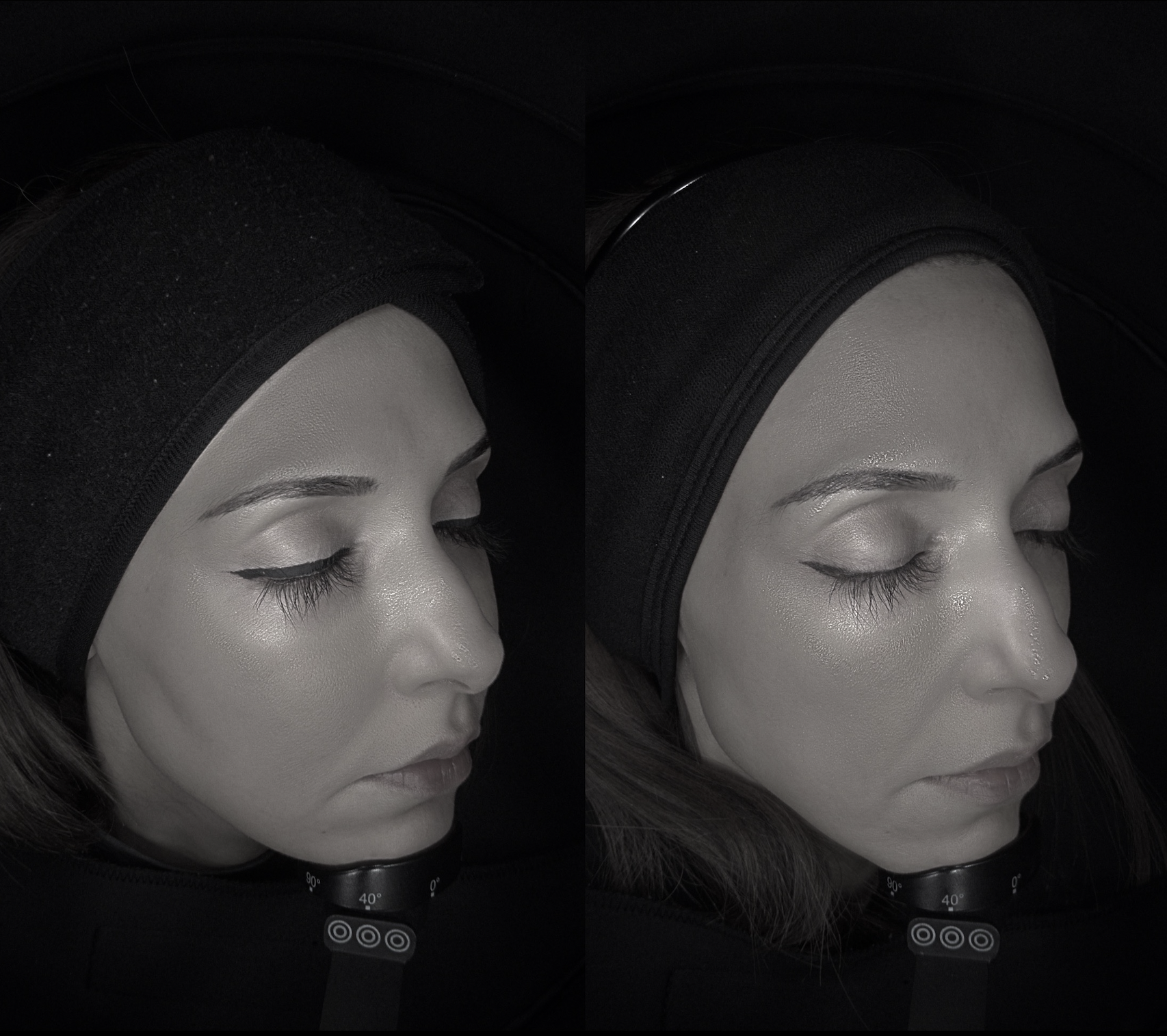 Skin Diagnostic 