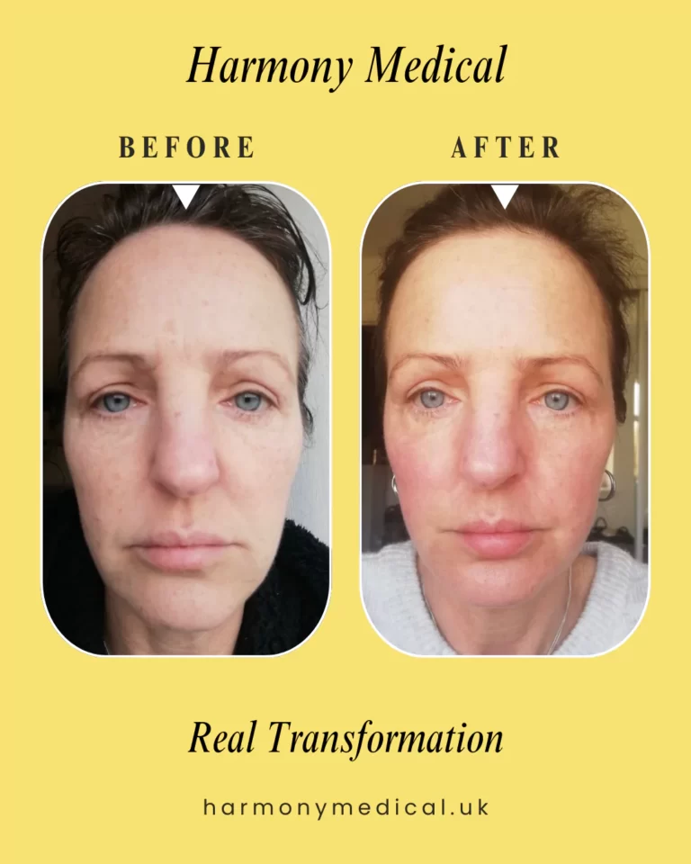 harmony-medical-before-after-img-002